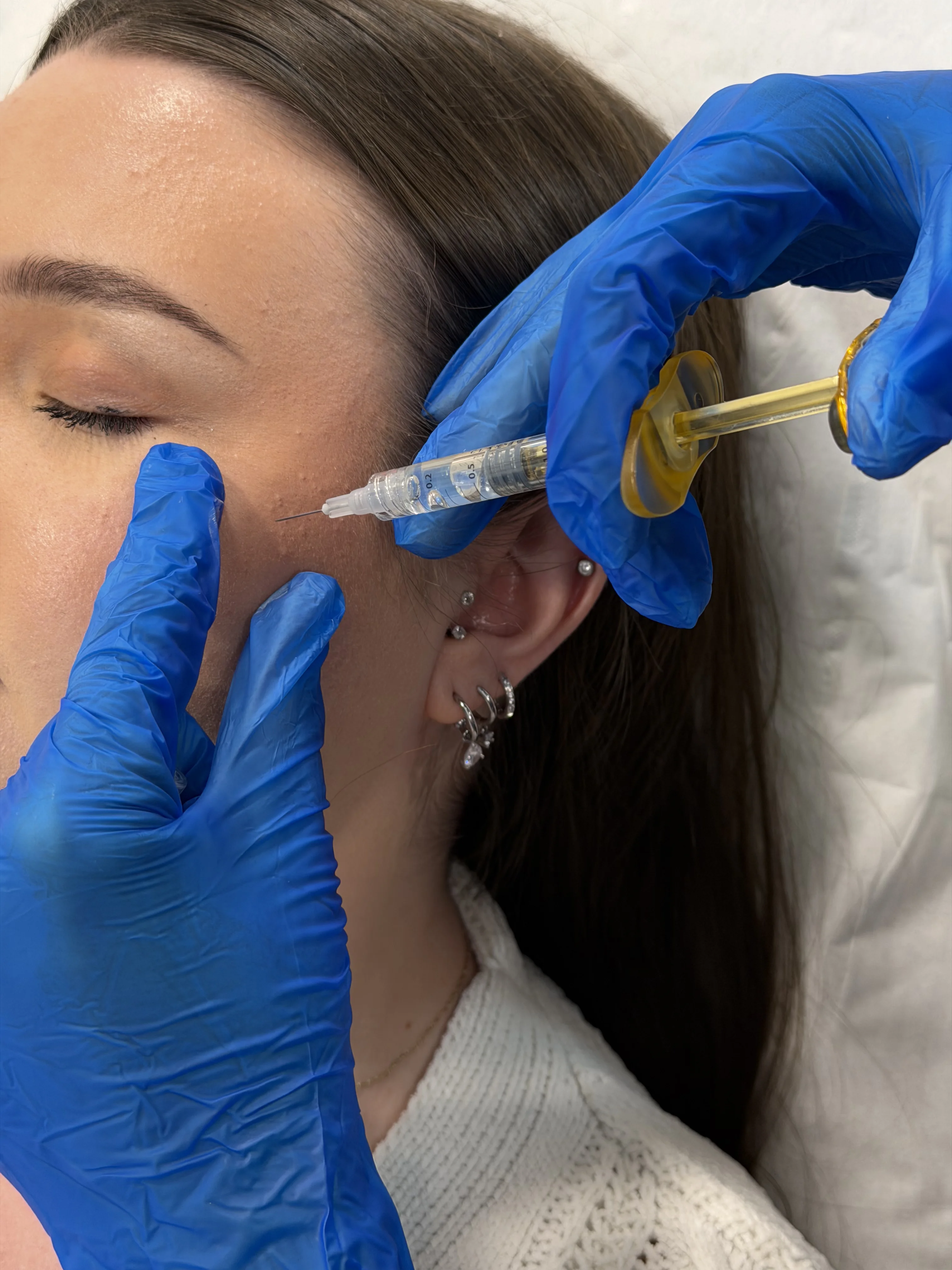 Epidermal Cryo-Cooling System