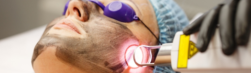 Carbon Laser Facial Vs Instagram Filters - Which One Truly Makes You Glow?