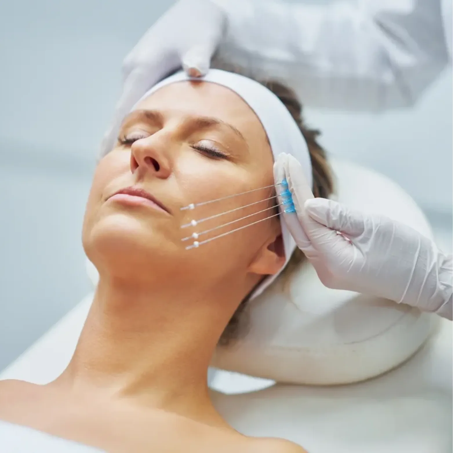 Endolift Treatment