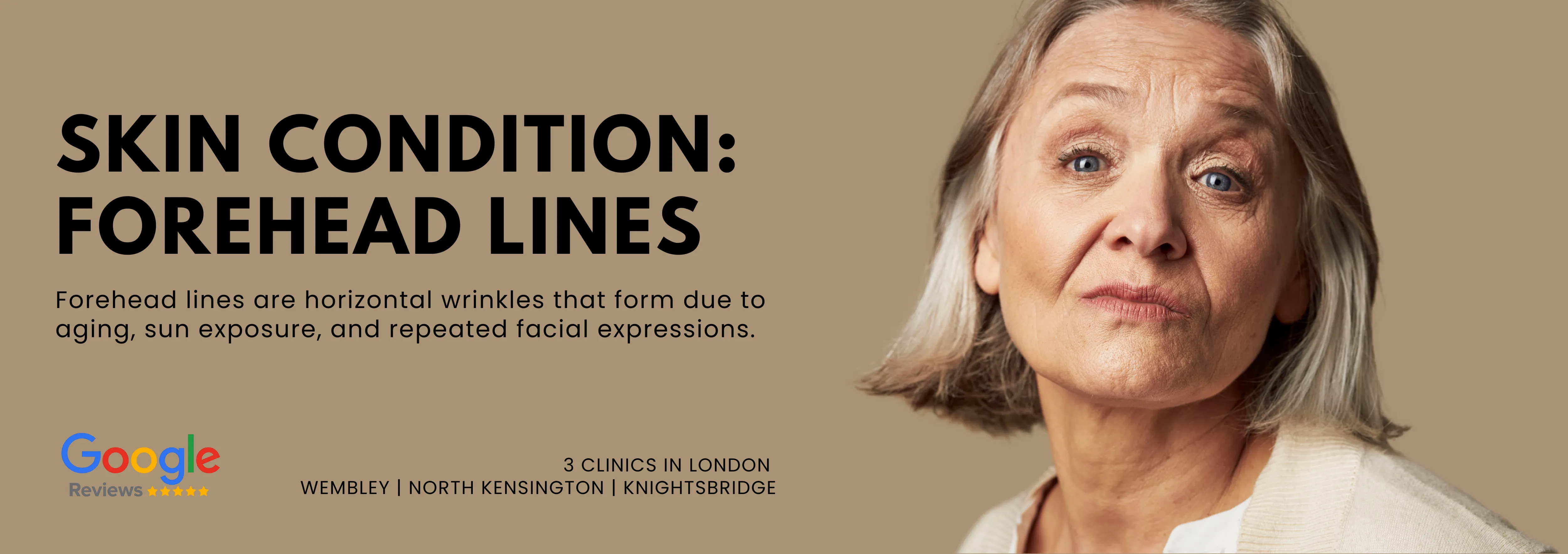 Forehead lines