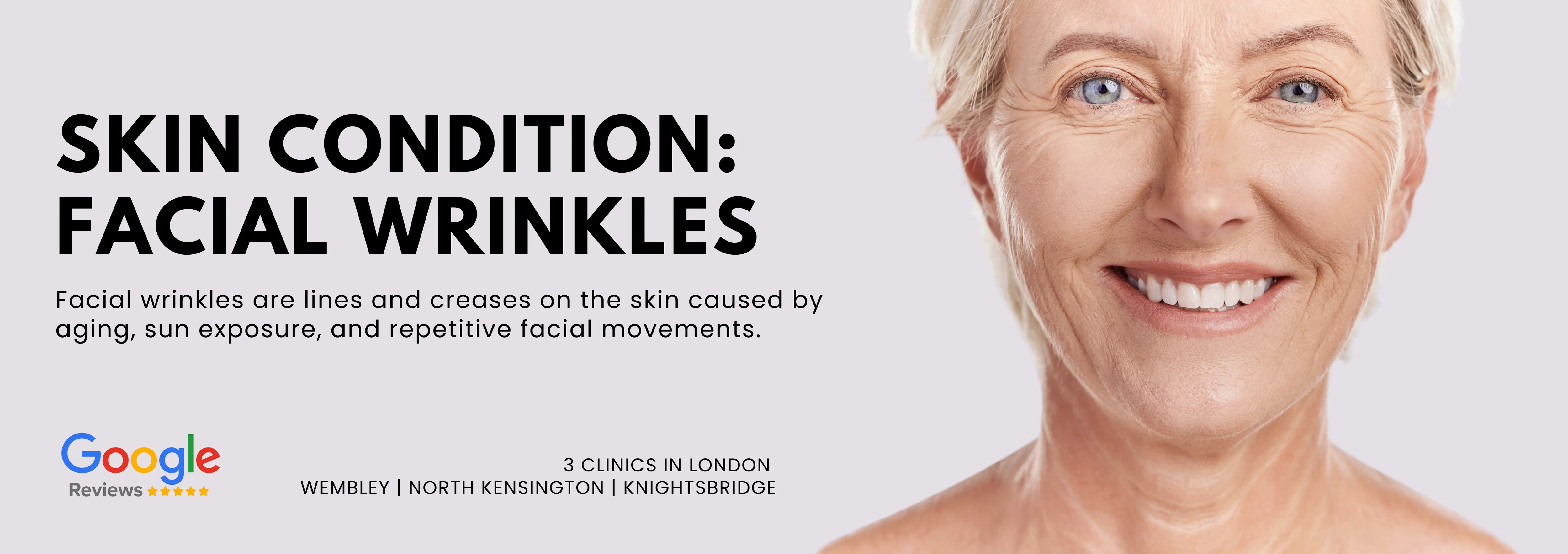 Facial Wrinkles