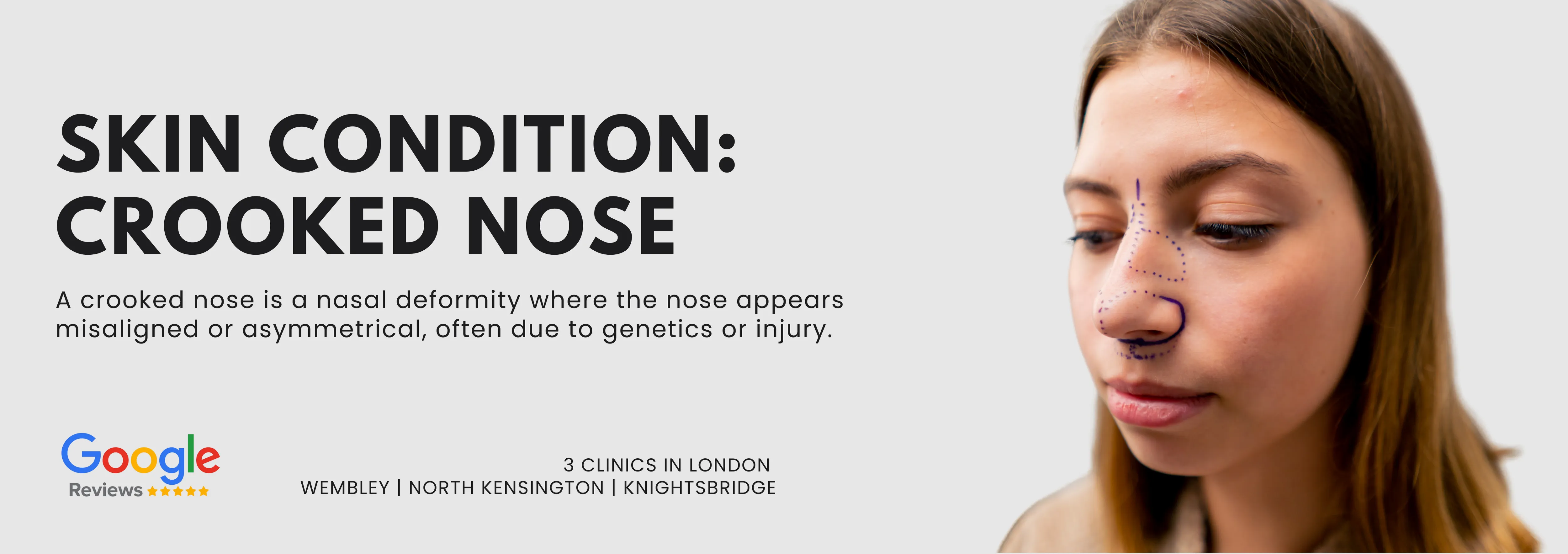 Crooked Nose