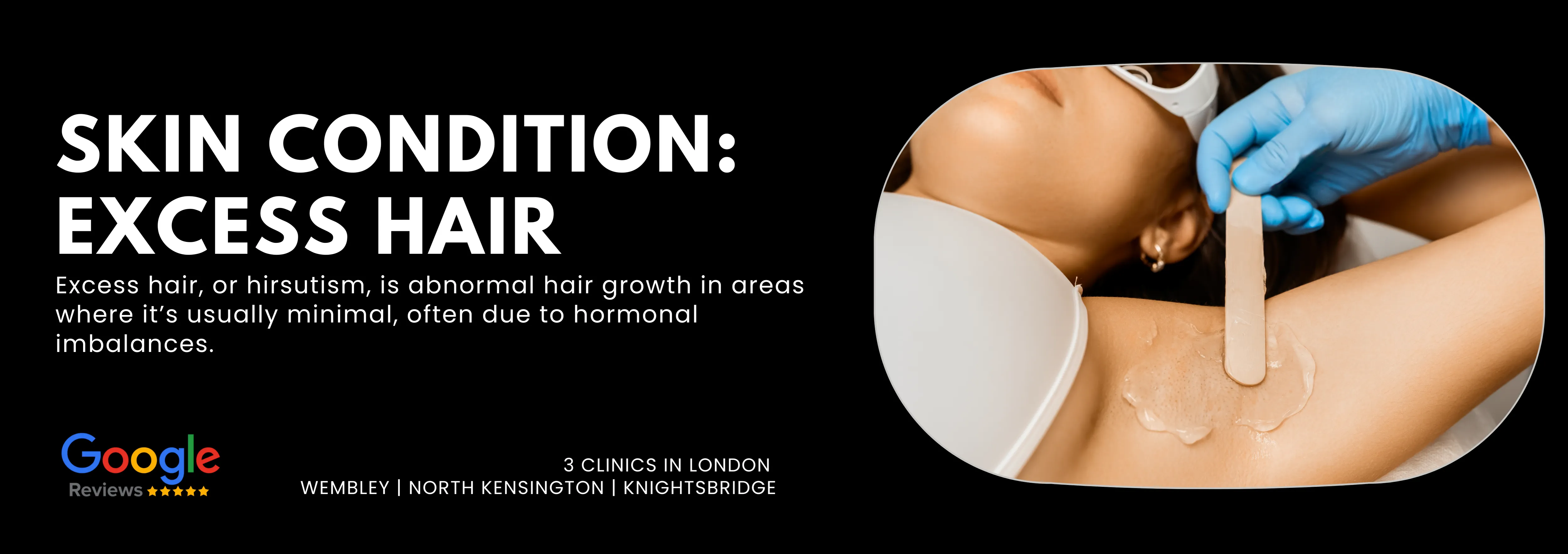 Excess Hair