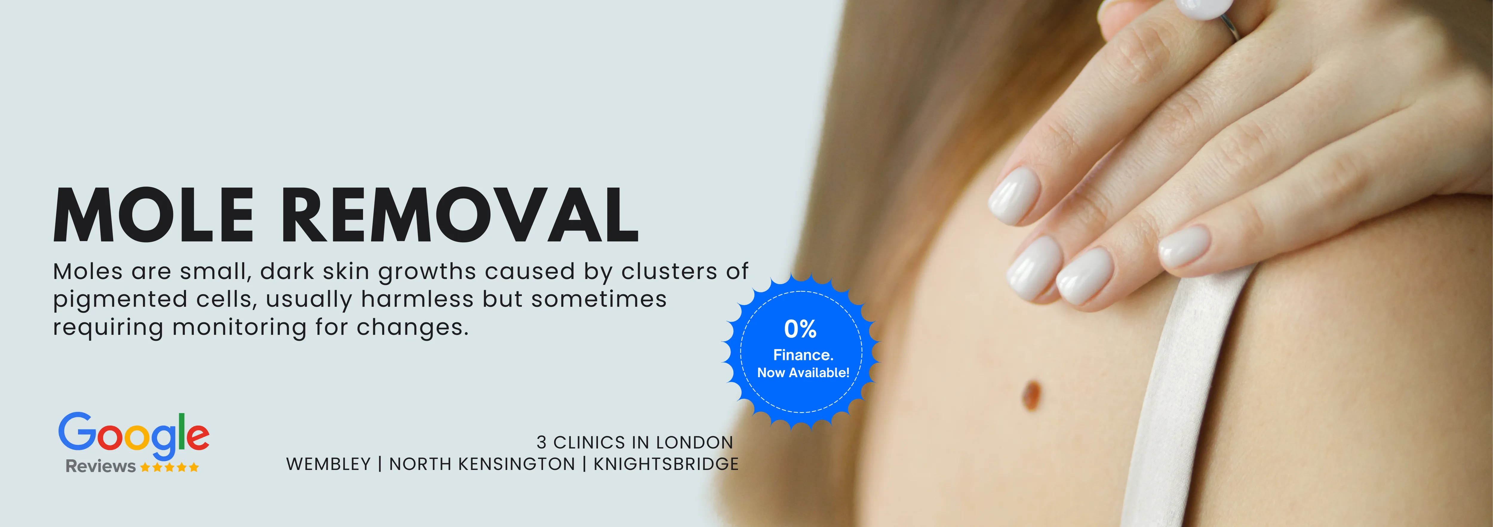 Laser Mole Removal
