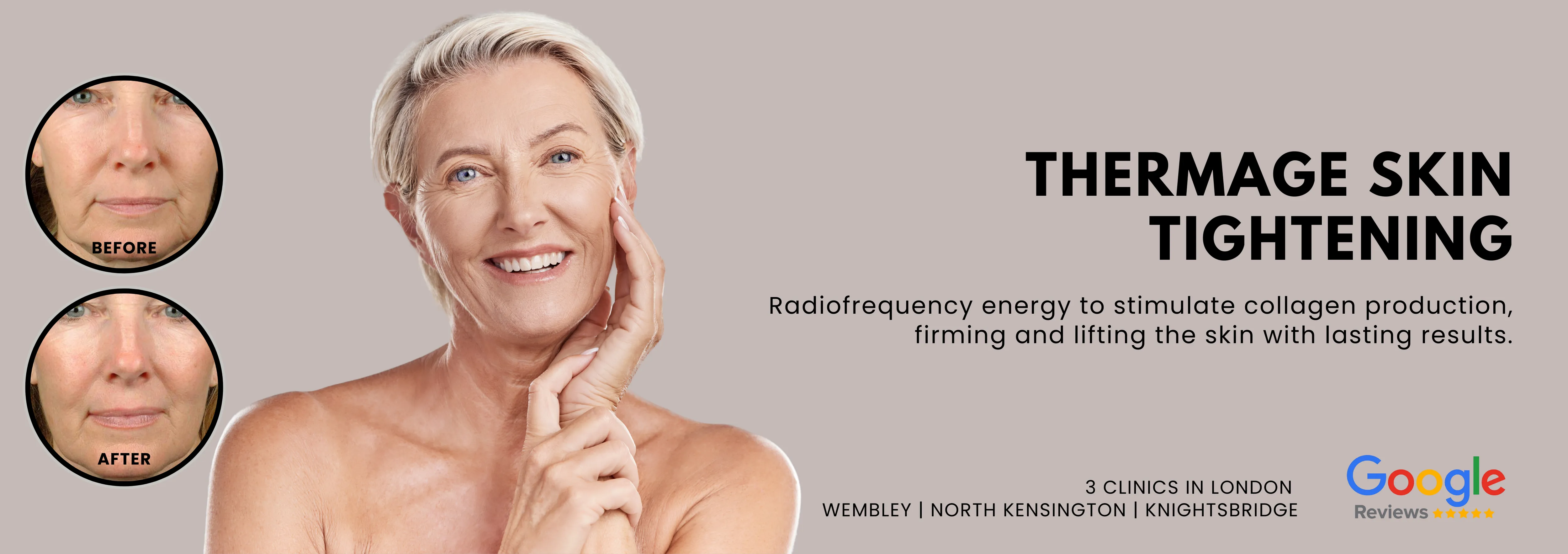 Thermage Skin Tightening
