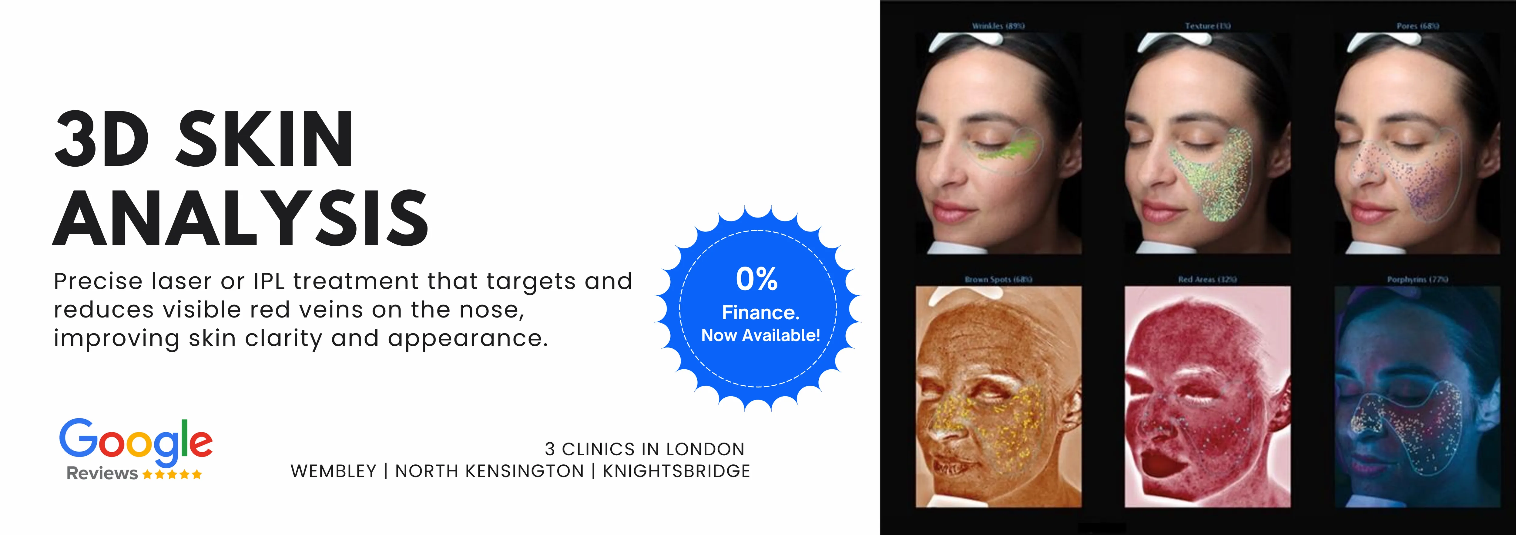 3D Skin Analysis
