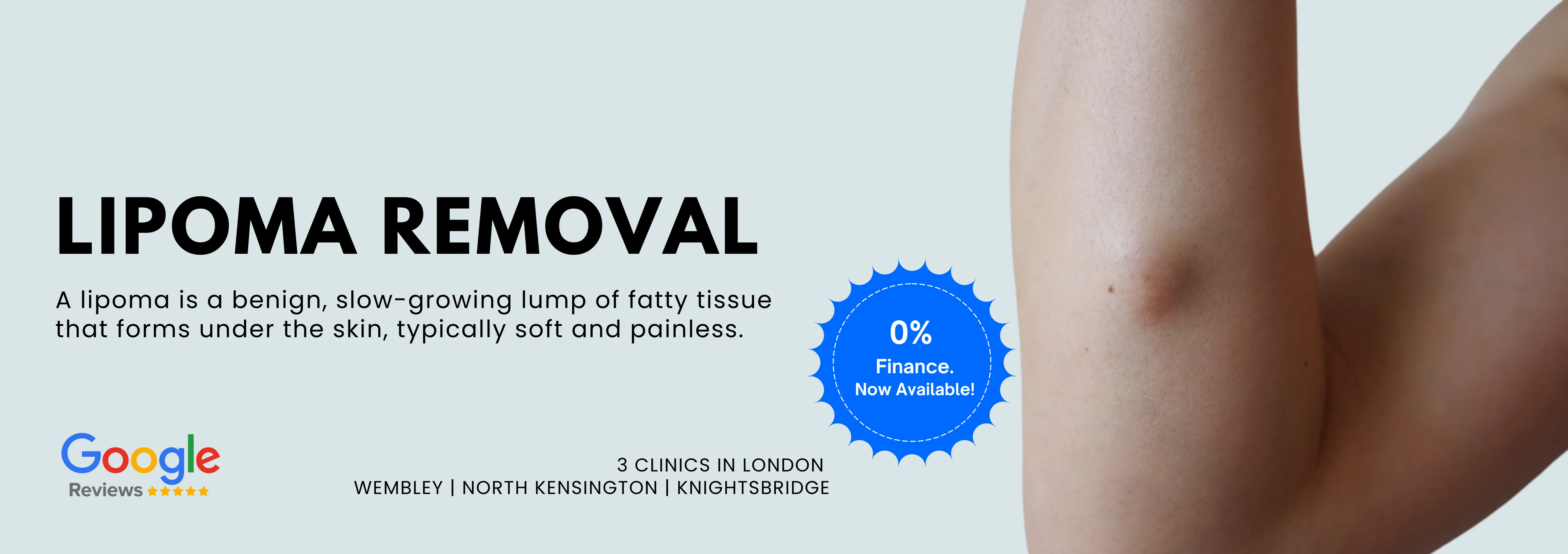 Lipoma Removal