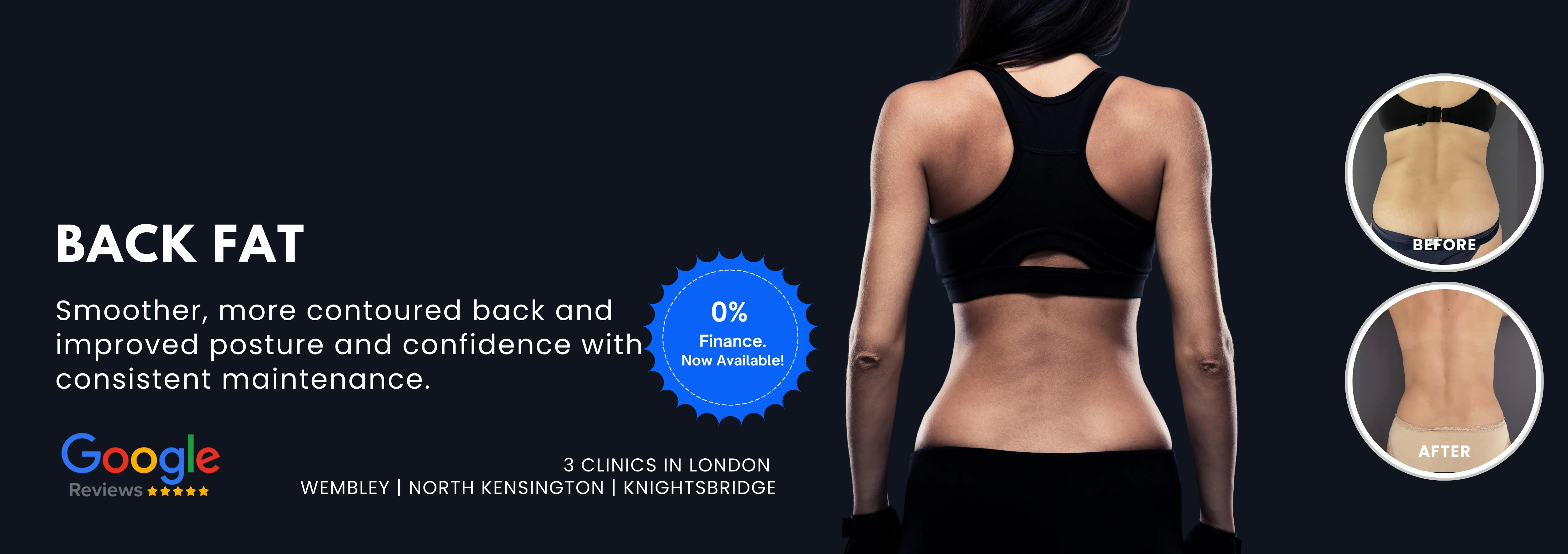 Back Fat