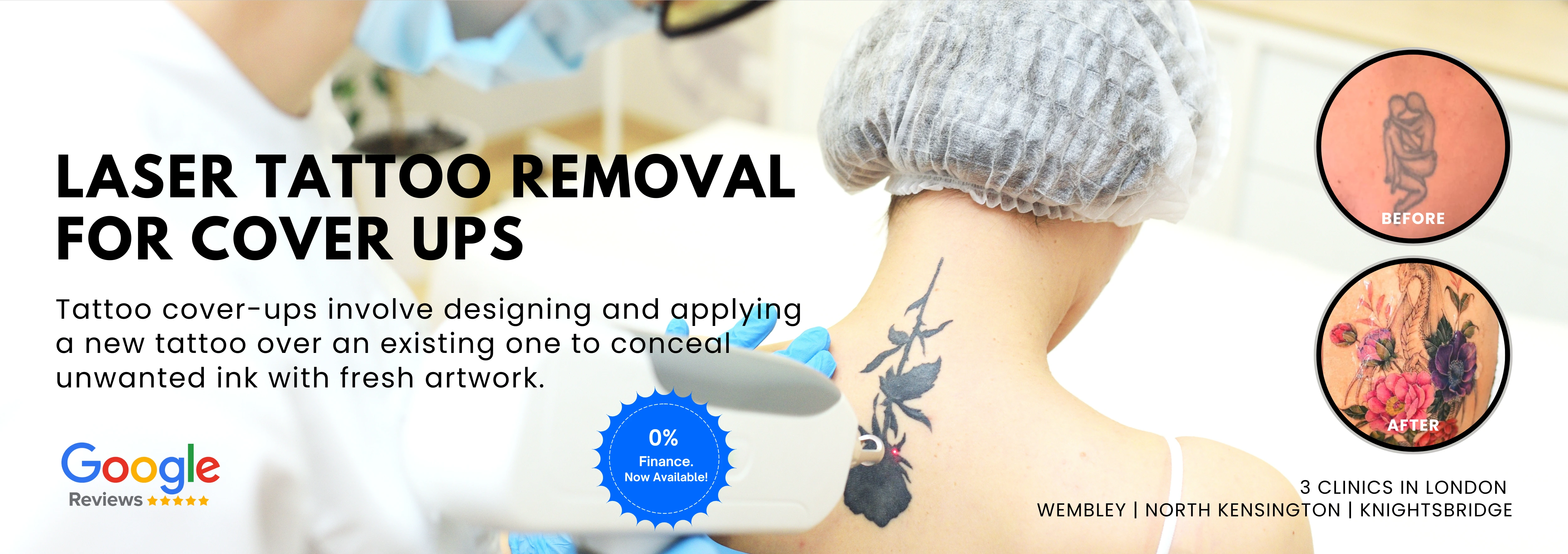 Tattoo Cover Ups