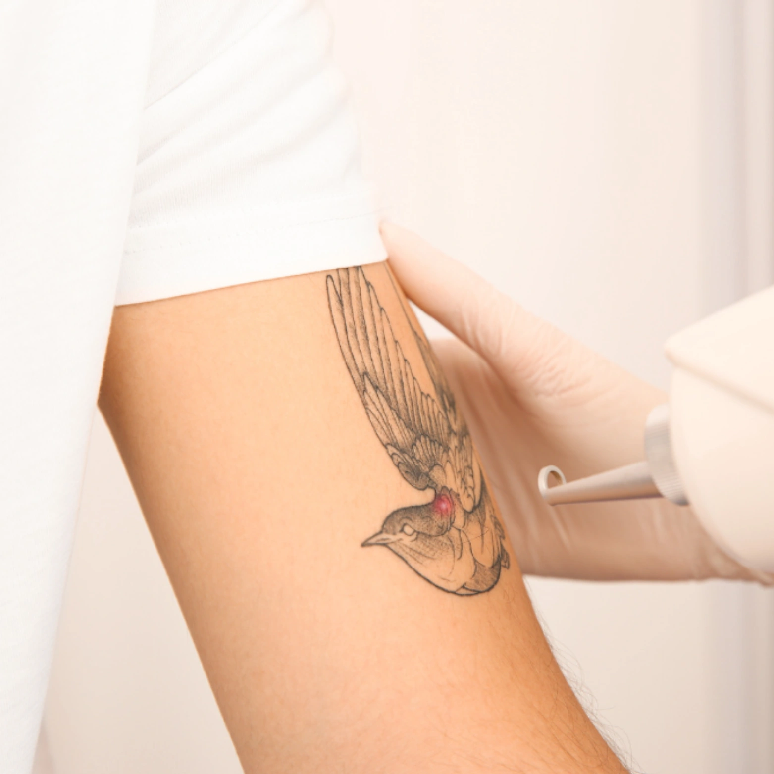 Unwanted Tattoo