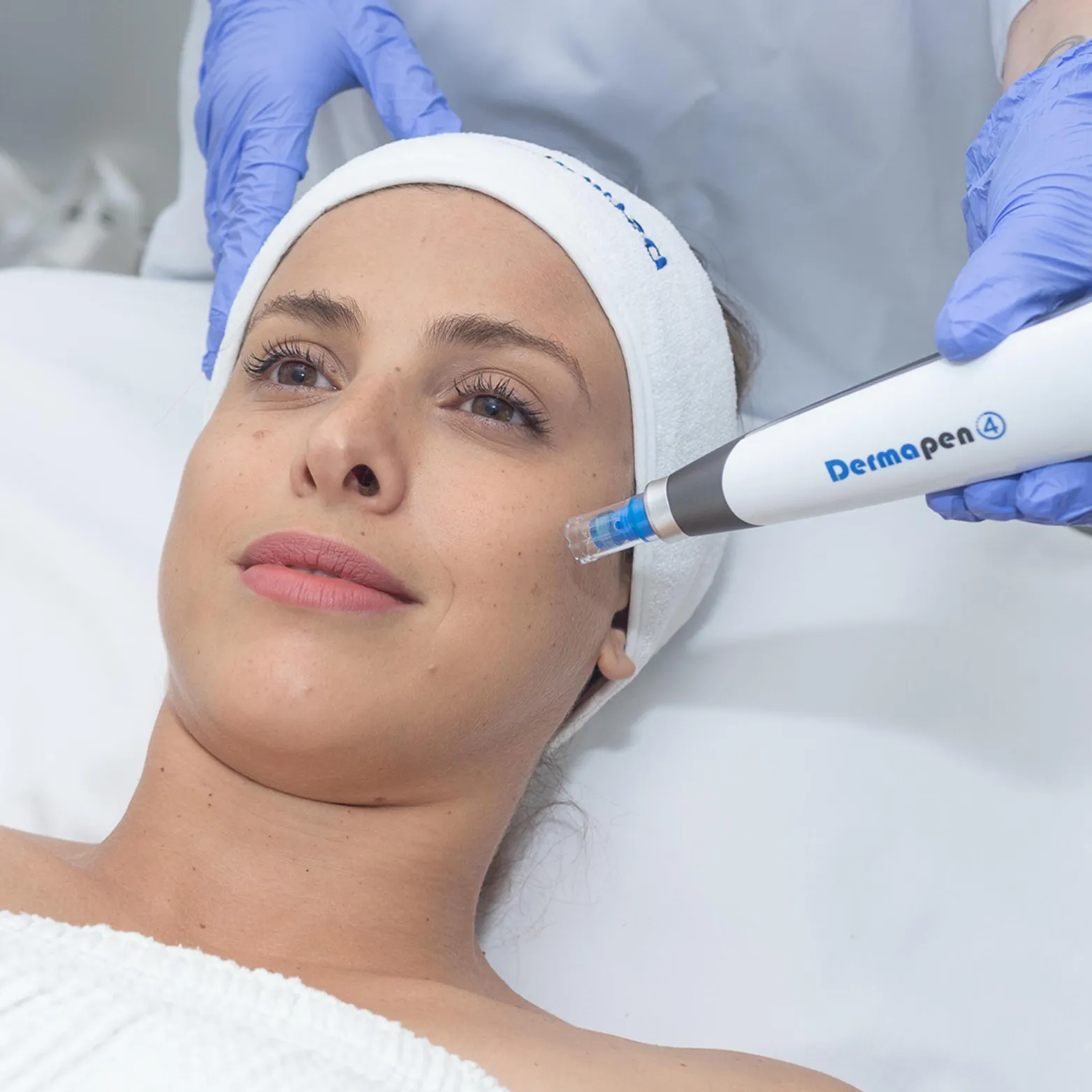 Dermapen Microneedling