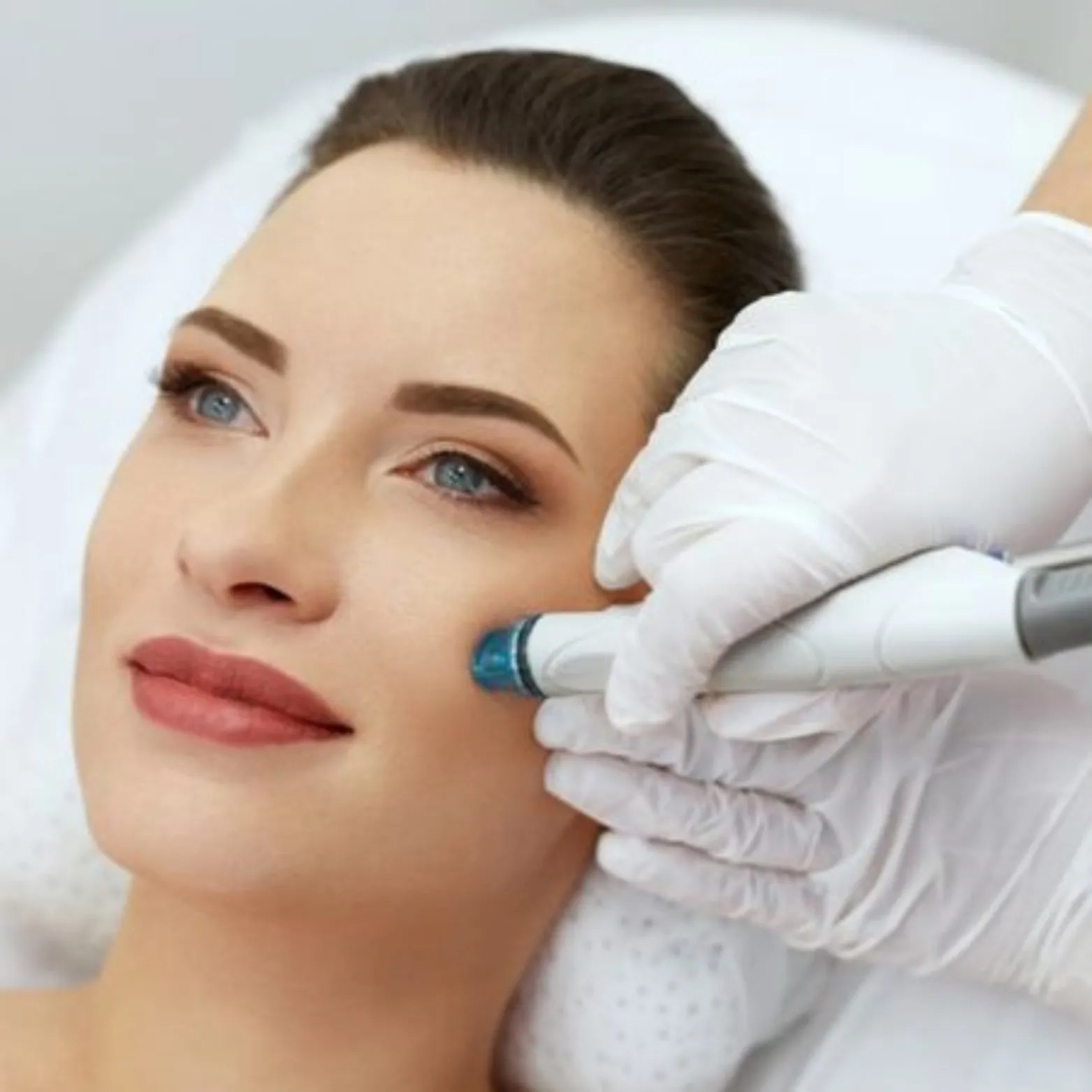 Halo Laser Treatment Sale