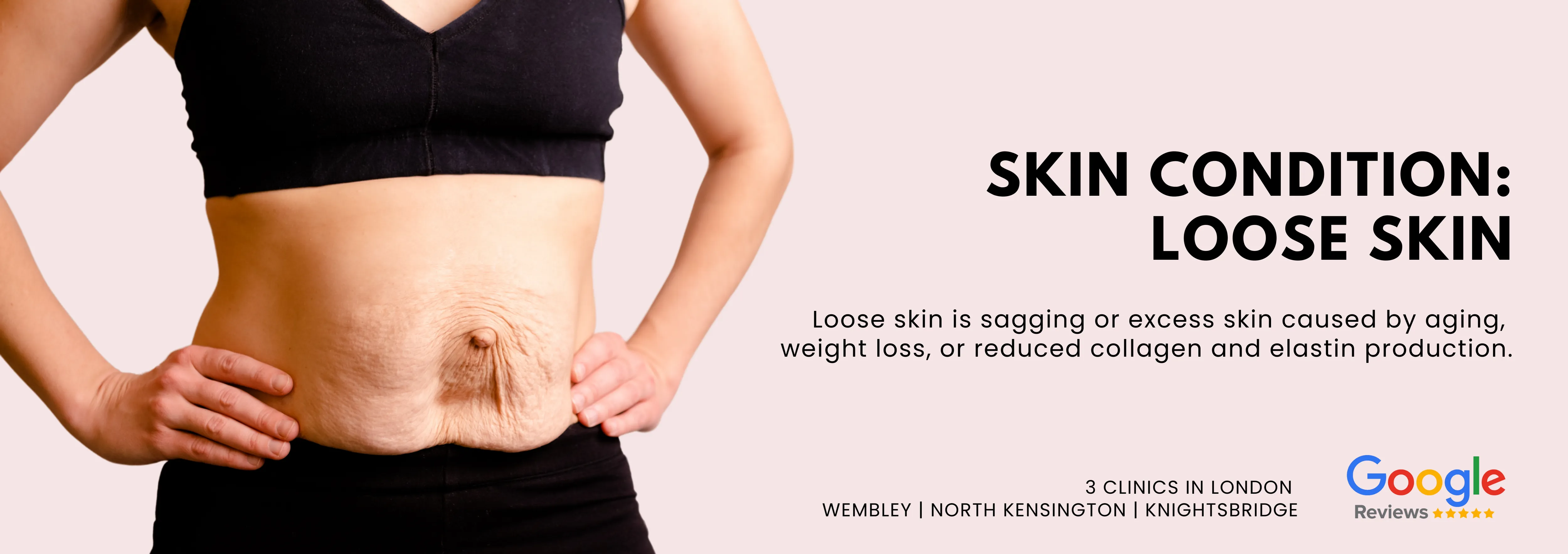 Loose Skin