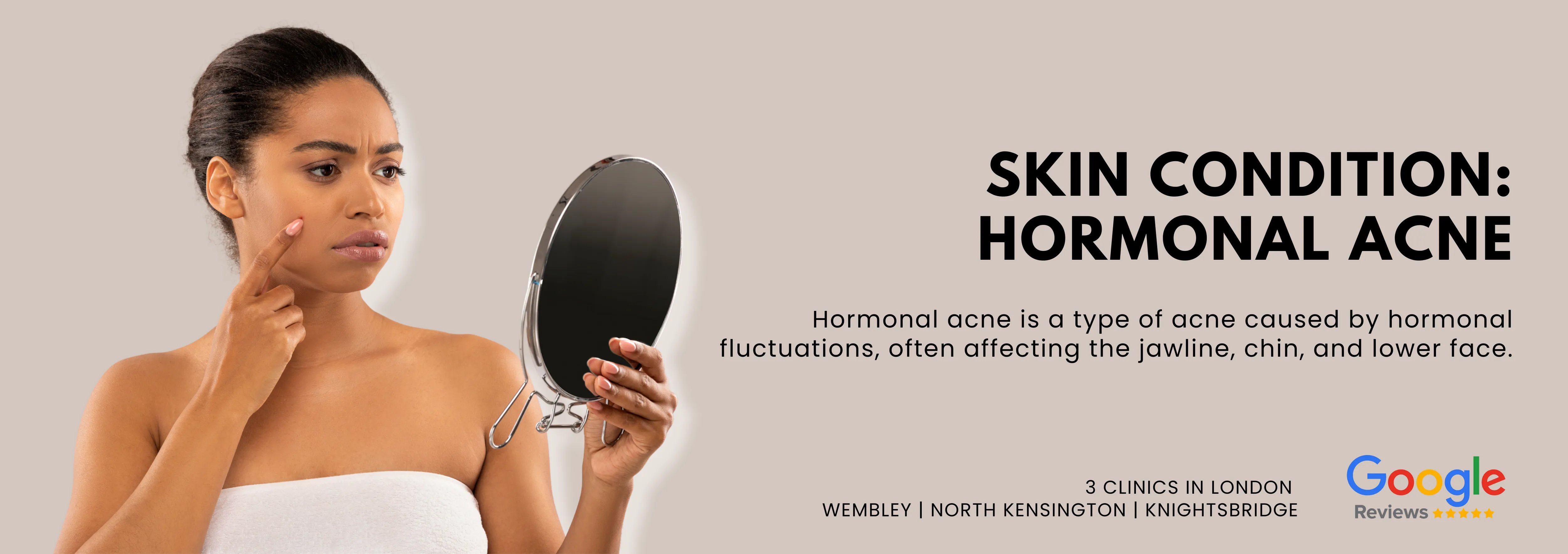 Hormonal Acne