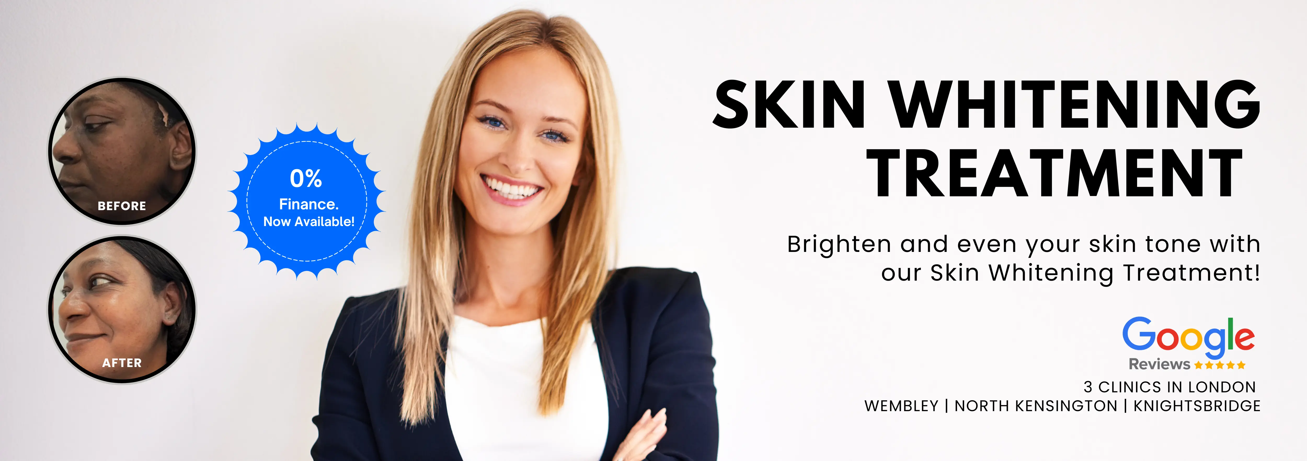 Skin Whitening