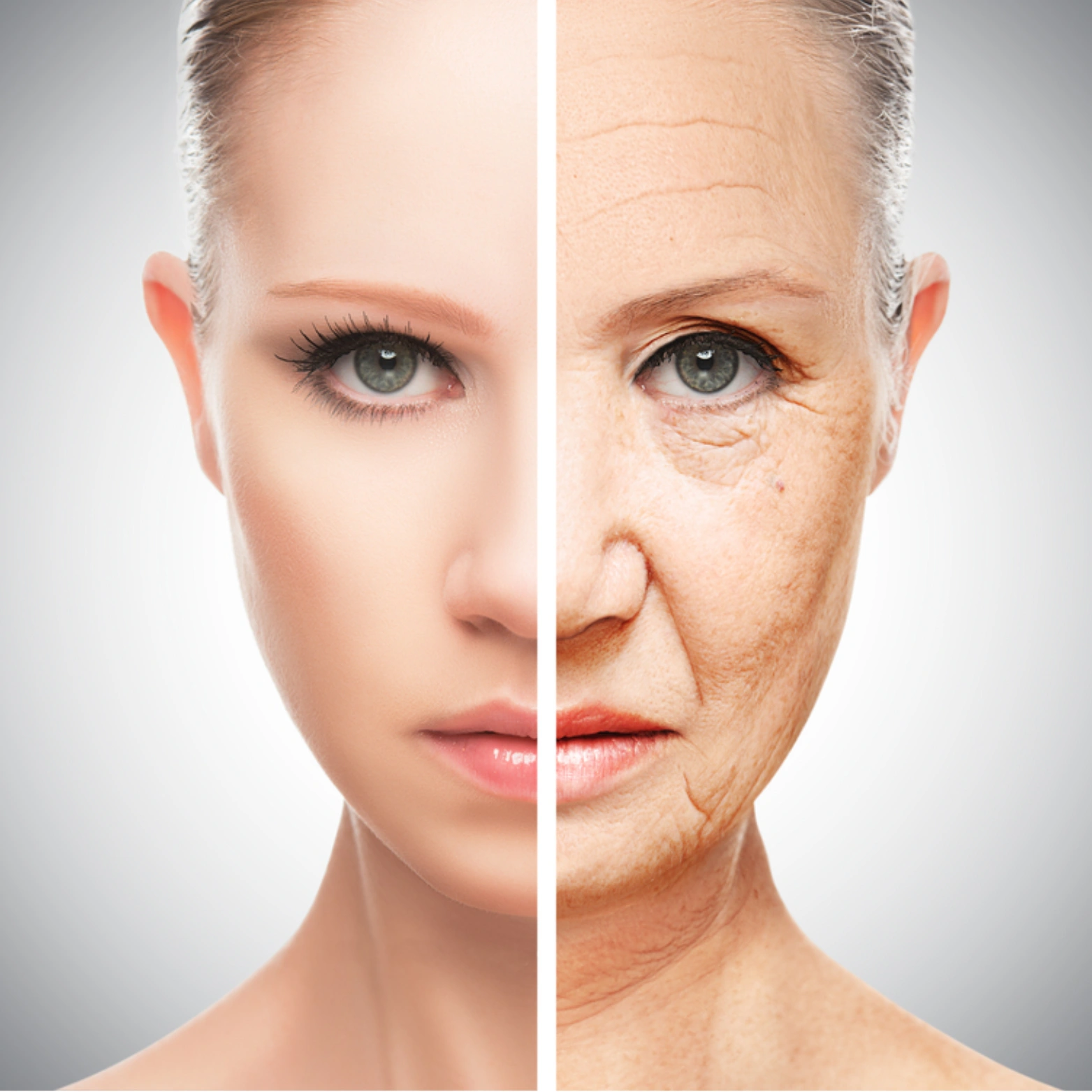 Facial Wrinkles