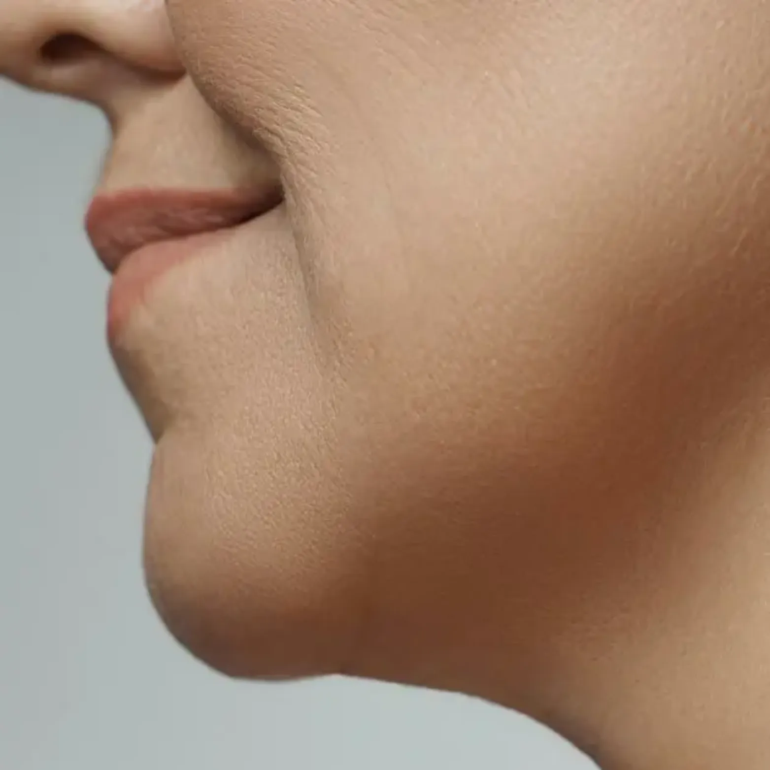 Weak Jawline
