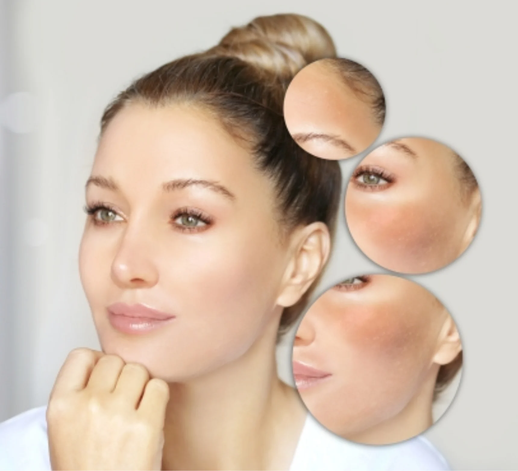 Skin Whitening