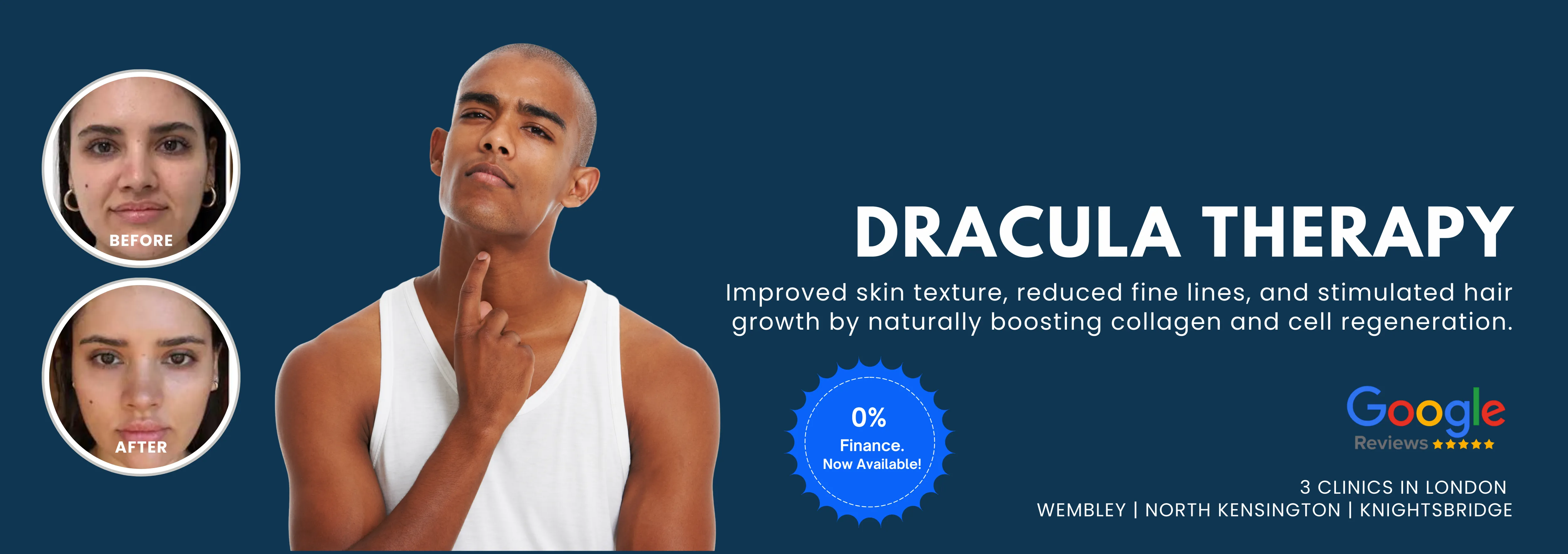 Dracula Therapy
