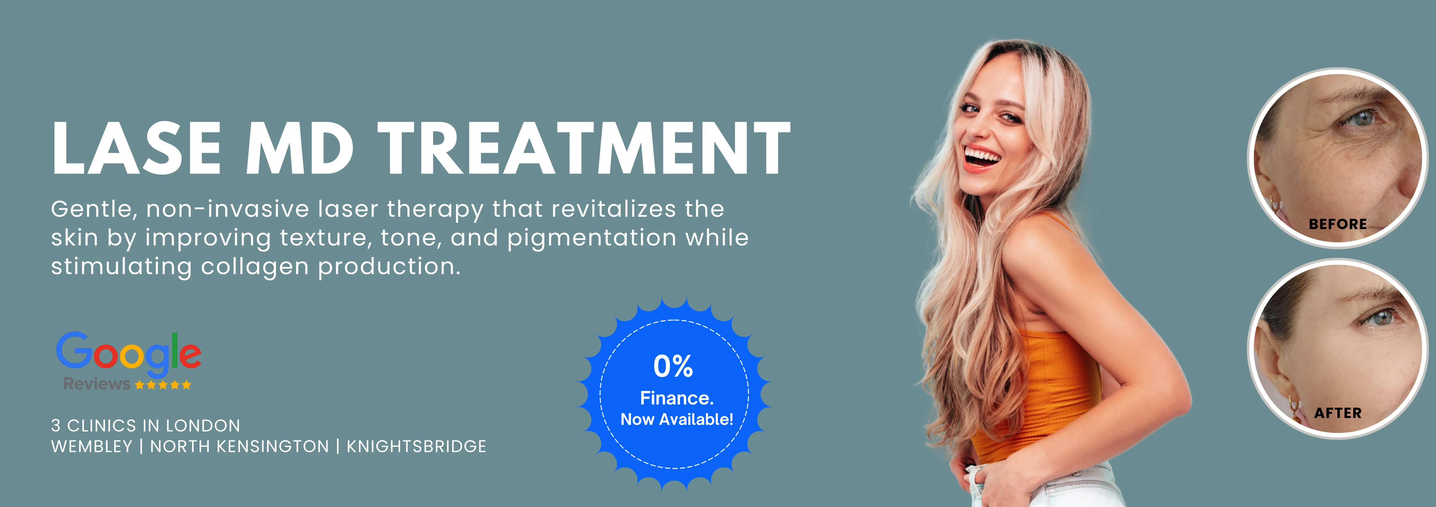 LaseMD Treatment