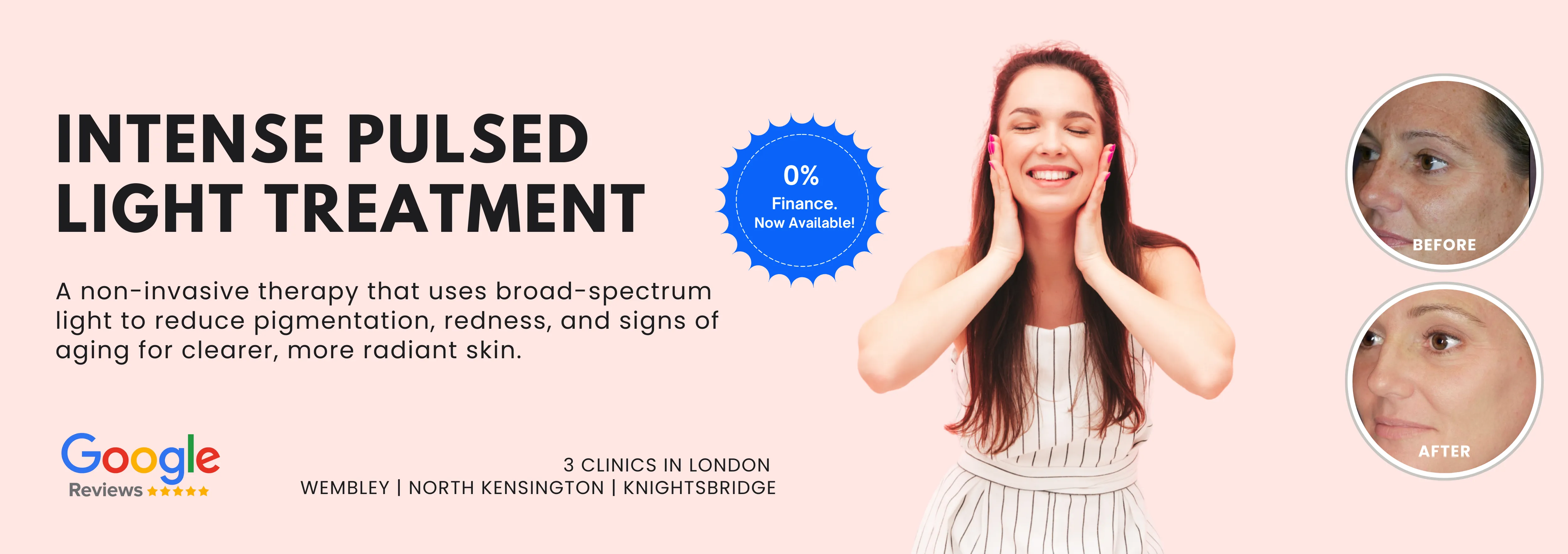Intense Pulsed Light Treatment